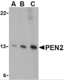 Western blot analysis of PEN2 in K562 cell lysate with PEN2 antibody at (A) 0.5, (B) 1, and (C) 2 &#956;g/mL. 