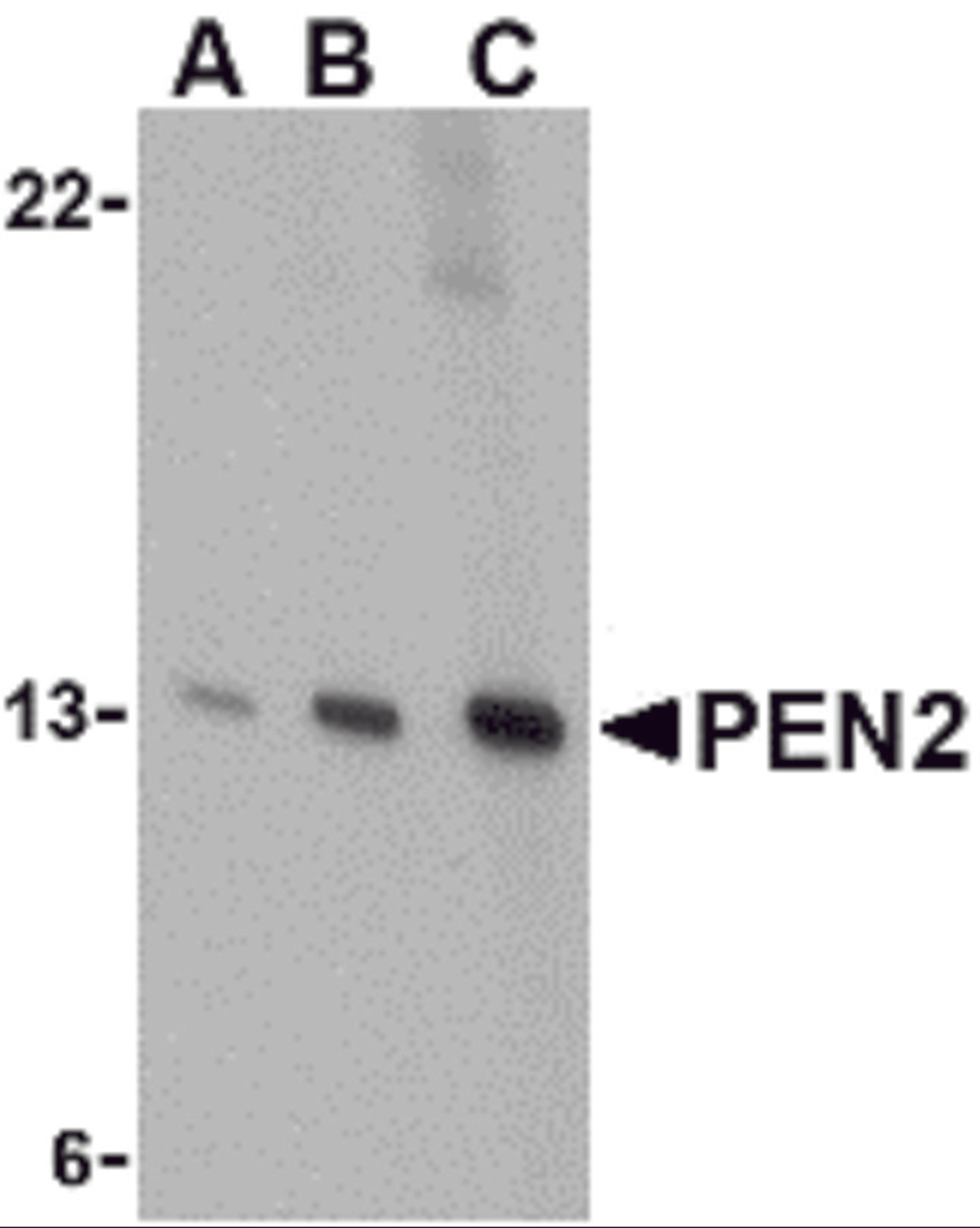 Western blot analysis of PEN2 in K562 cell lysate with PEN2 antibody at (A) 0.5, (B) 1, and (C) 2 &#956;g/mL. 