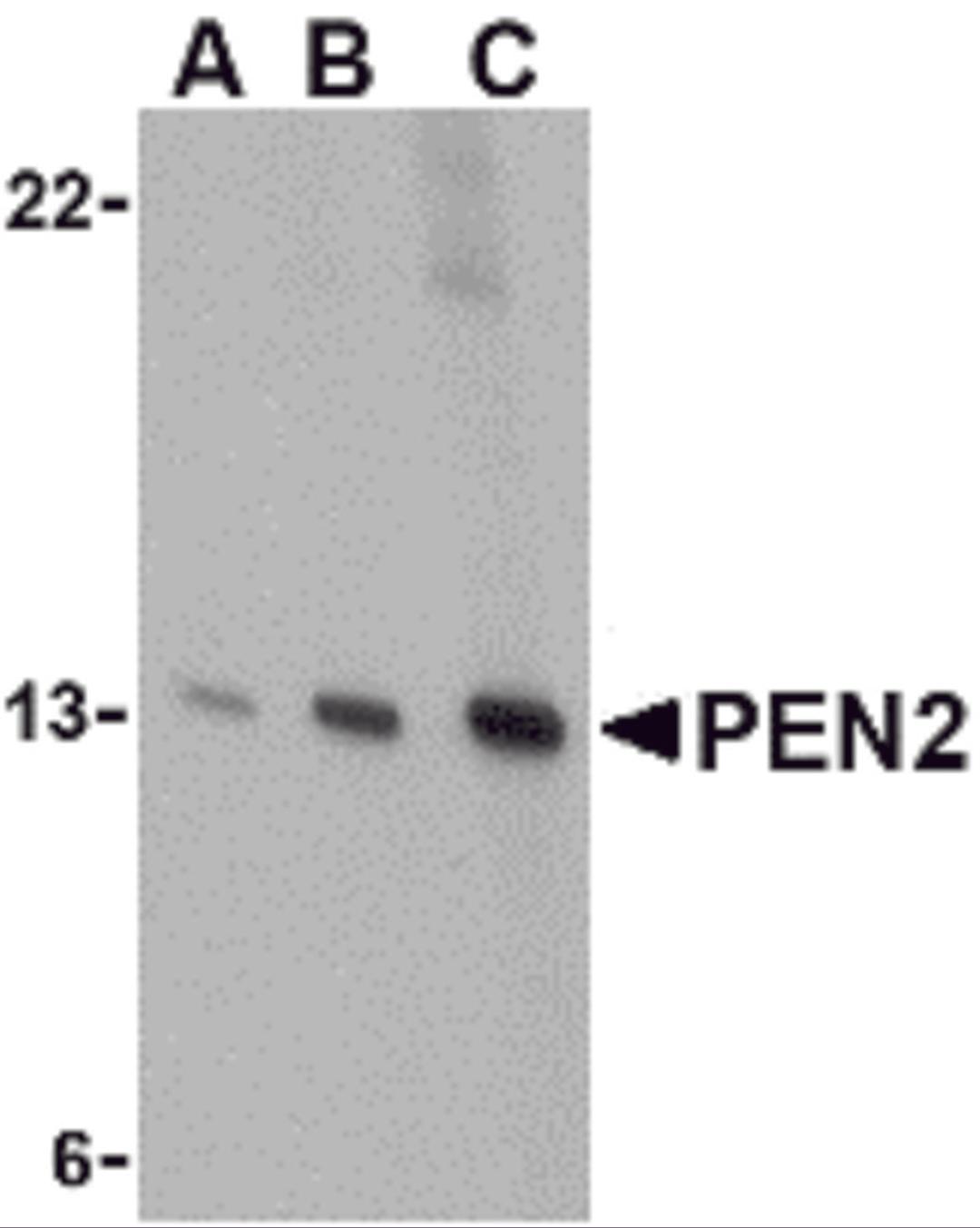 Western blot analysis of PEN2 in K562 cell lysate with PEN2 antibody at (A) 0.5, (B) 1, and (C) 2 μg/mL.