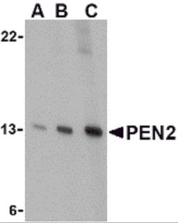 Western blot analysis of PEN2 in K562 cell lysate with PEN2 antibody at (A) 0.5, (B) 1, and (C) 2 μg/mL.