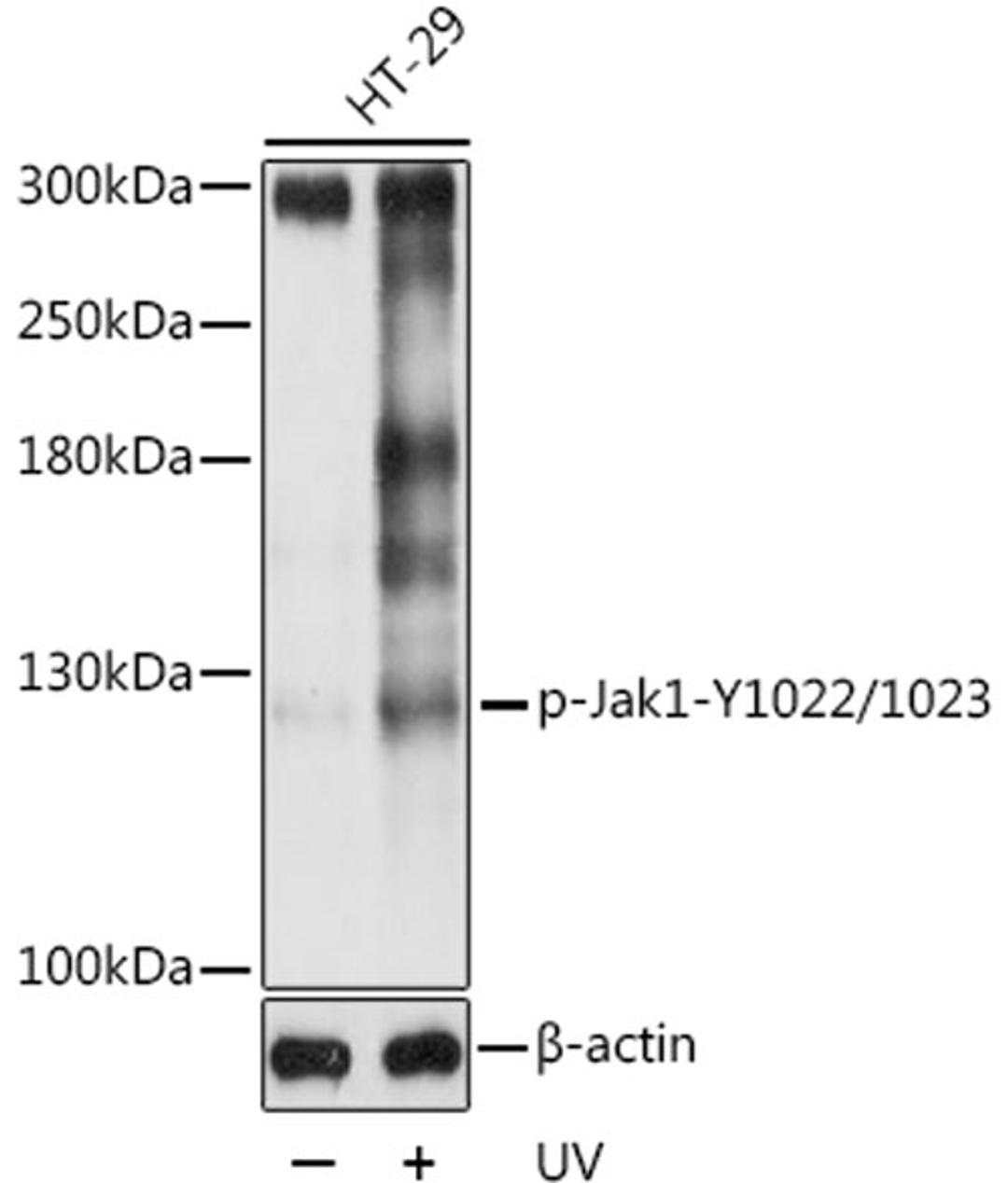 Western blot - Phospho-Jak1-Y1022/1023 pAb (AP0530)