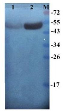 Western blot analysis of  human breast cancer-25 (Lane 1), human breast cancer-24 (Lane 2) using Cytokeratin7 antibody(antibody dilution at :1:200)