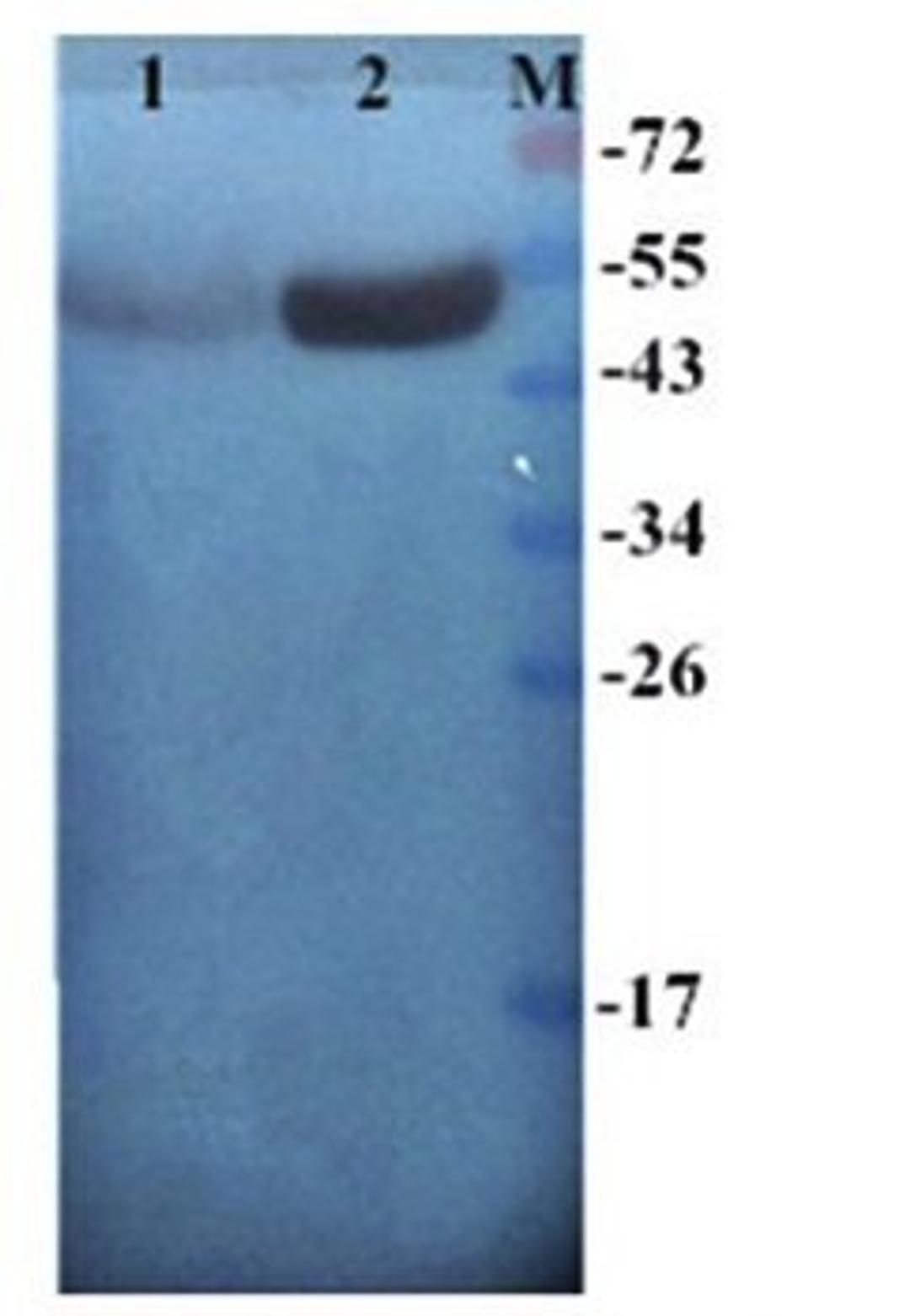 Western blot analysis of human breast cancer-25 (Lane 1), human breast cancer-24 (Lane 2) using Cytokeratin7 antibody(antibody dilution at :1:200)