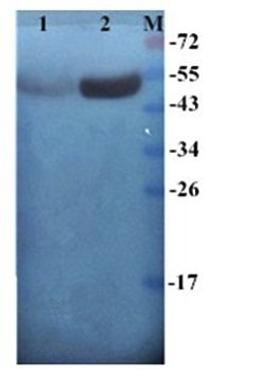 Western blot analysis of human breast cancer-25 (Lane 1), human breast cancer-24 (Lane 2) using Cytokeratin7 antibody(antibody dilution at :1:200)