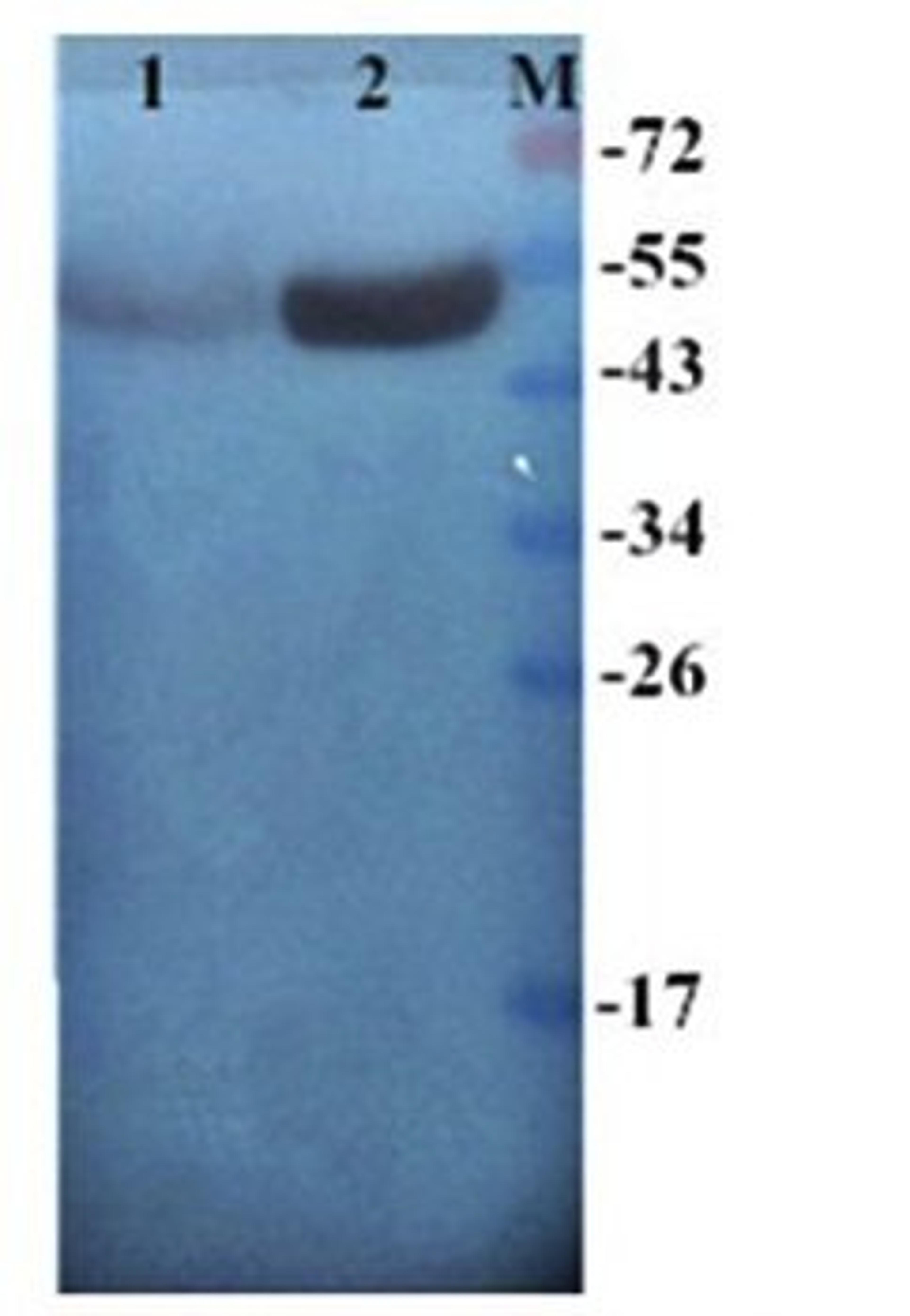 Western blot analysis of human breast cancer-25 (Lane 1), human breast cancer-24 (Lane 2) using Cytokeratin7 antibody(antibody dilution at :1:200)