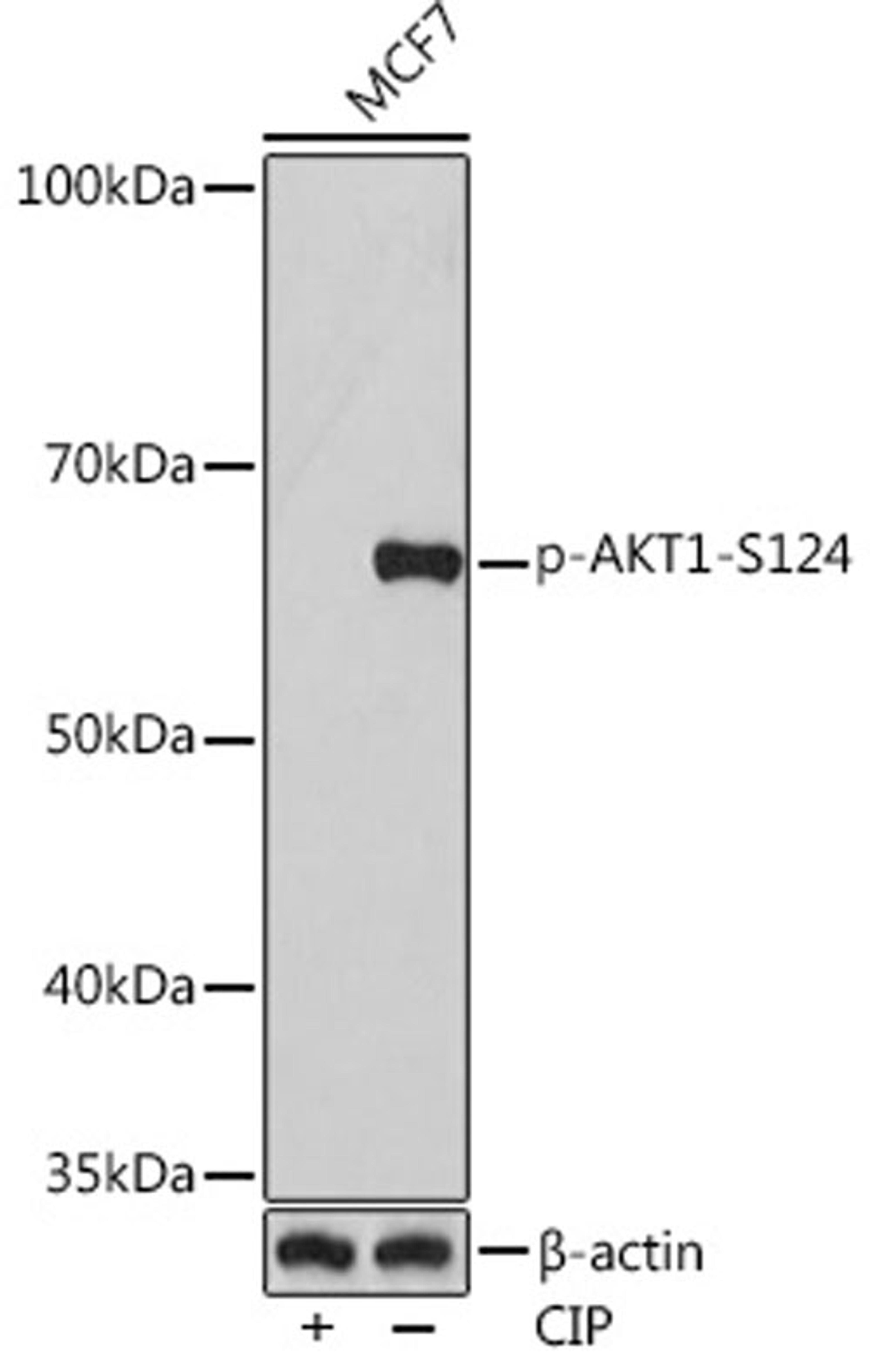 Western blot - Phospho-AKT1-S124 Rabbit mAb (AP0982)