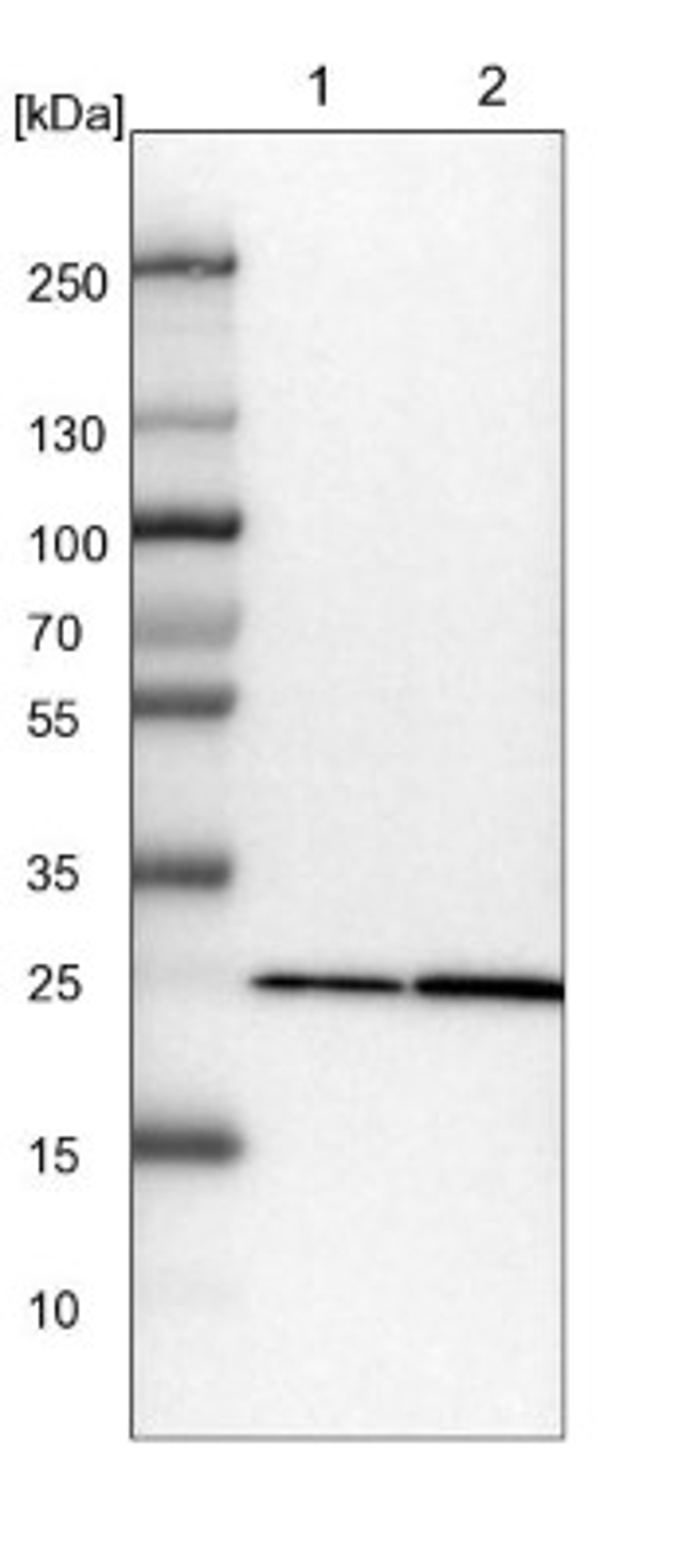 Western Blot: PMM1/Phosphomannomutase 1 Antibody [NBP1-87055] - Lane 1: NIH-3T3 cell lysate (Mouse embryonic fibroblast cells)<br/>Lane 2: NBT-II cell lysate (Rat Wistar bladder tumour cells)