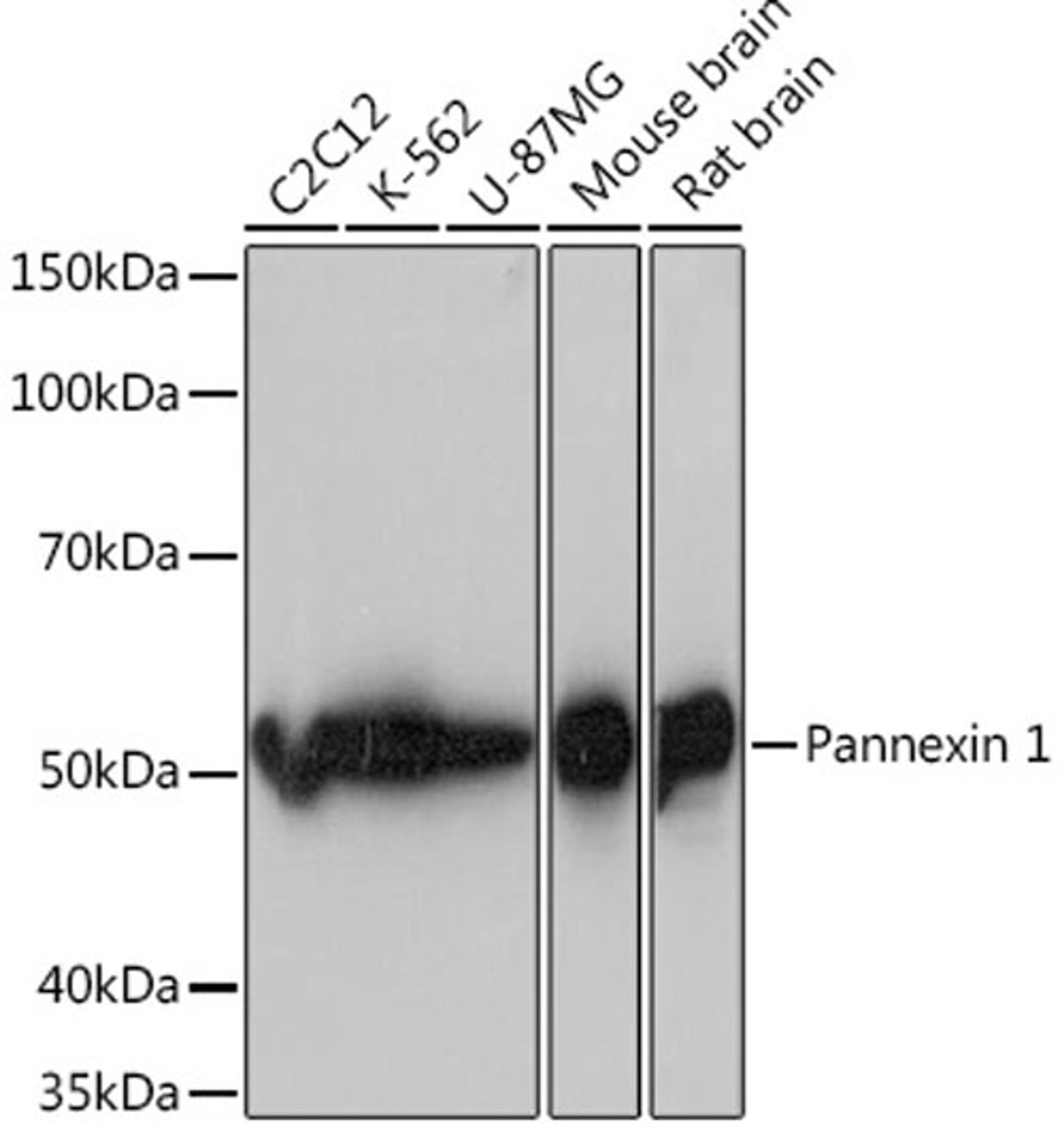 Western blot - Pannexin 1 Rabbit mAb (A5167)