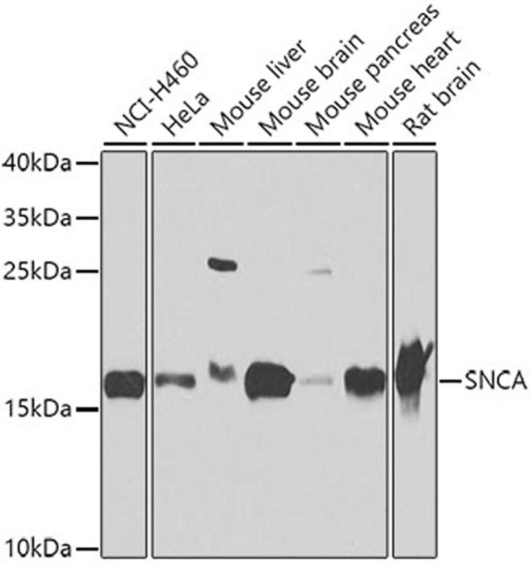 Western blot - SNCA antibody (A7215)