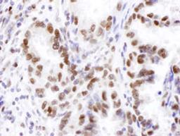 Detection of human JHDM1A by immunohistochemistry.