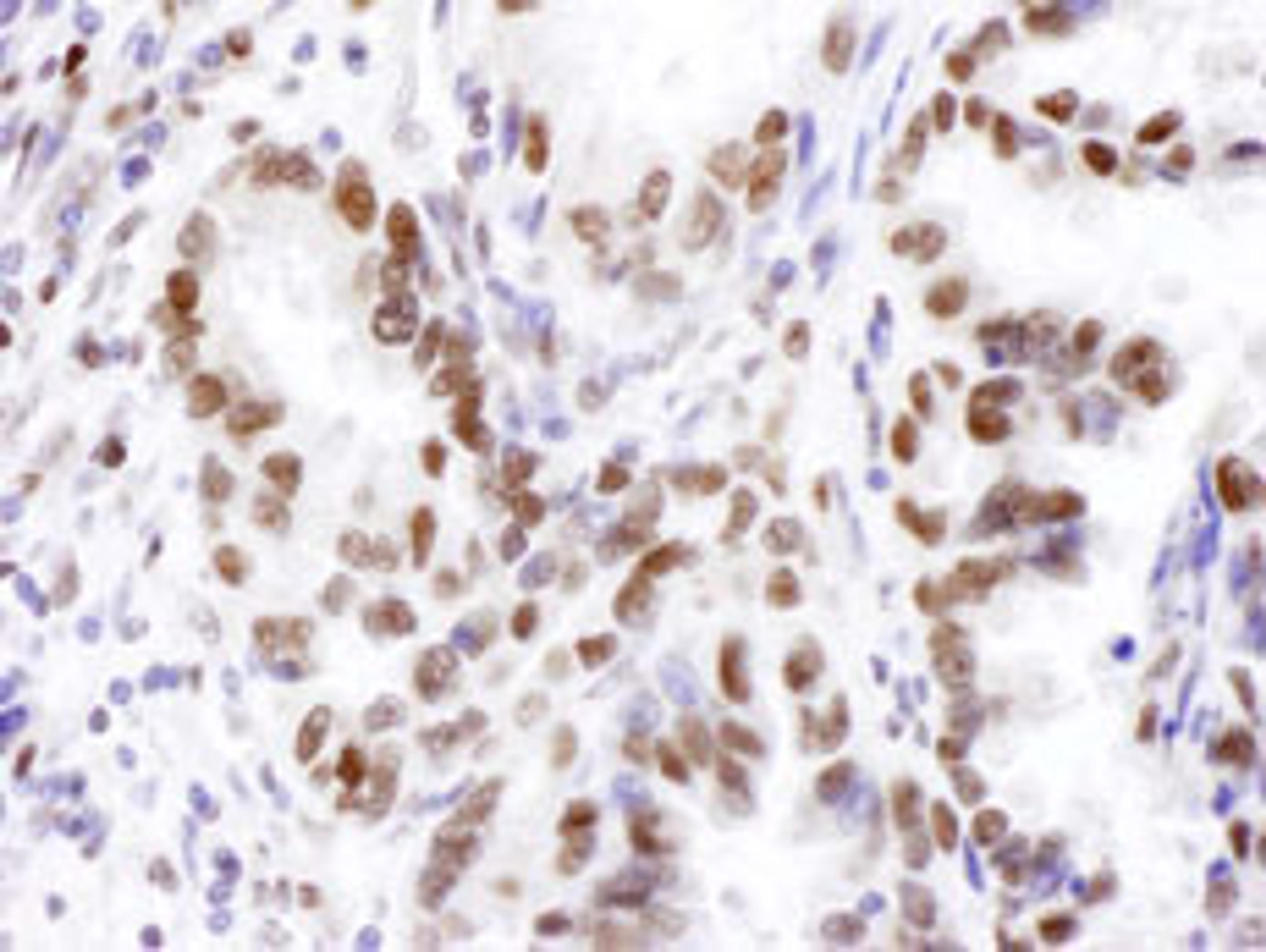 Detection of human JHDM1A by immunohistochemistry.