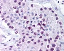 Immunohistochemistry staining of MAGEA6 in testis (formalin-fixed paraffin embedded) tissue using MAGEA6 Antibody.