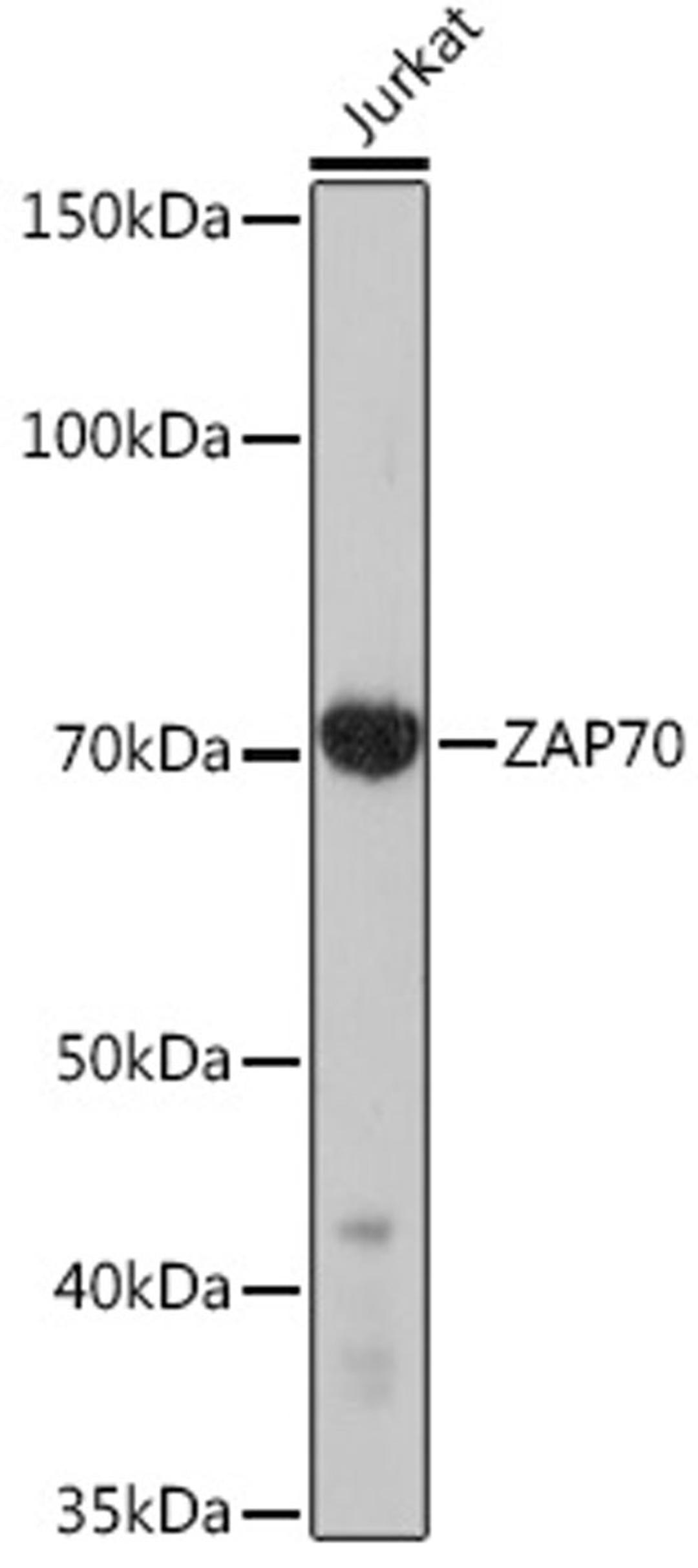 Western blot - ZAP70 Rabbit mAb (A9536)