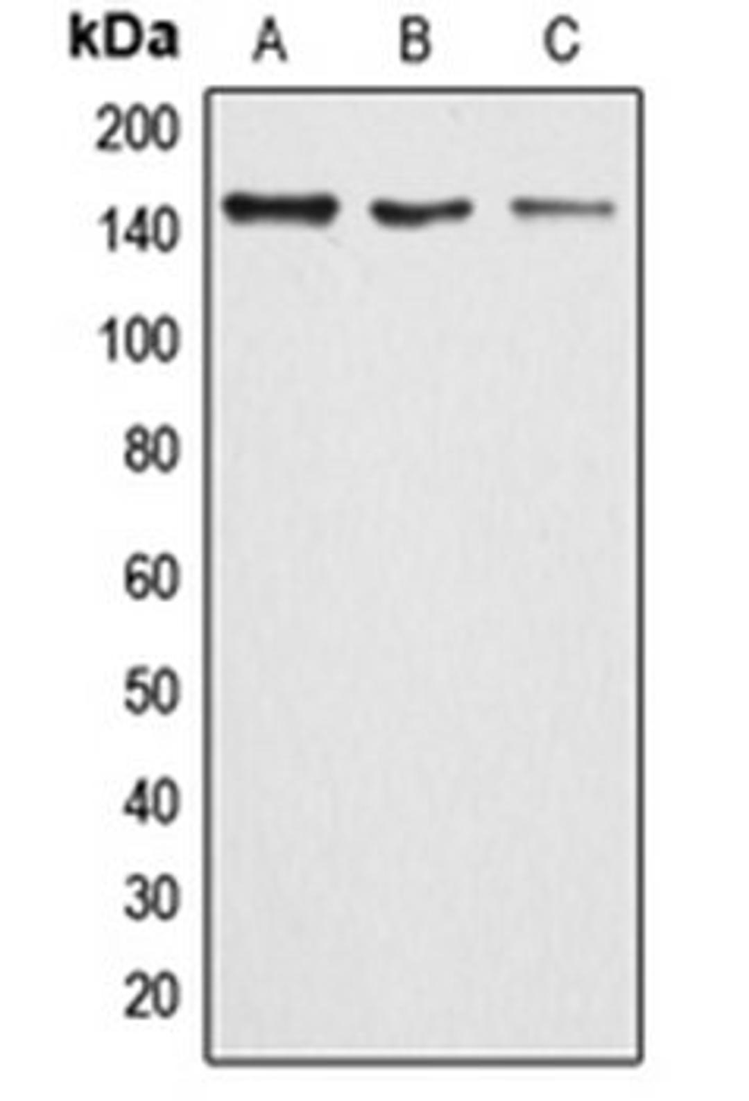 Western blot analysis of HeLa (Lane 1), MCF7 (Lane 2), rat lung (Lane 3) whole cell lysates using ARID4B antibody