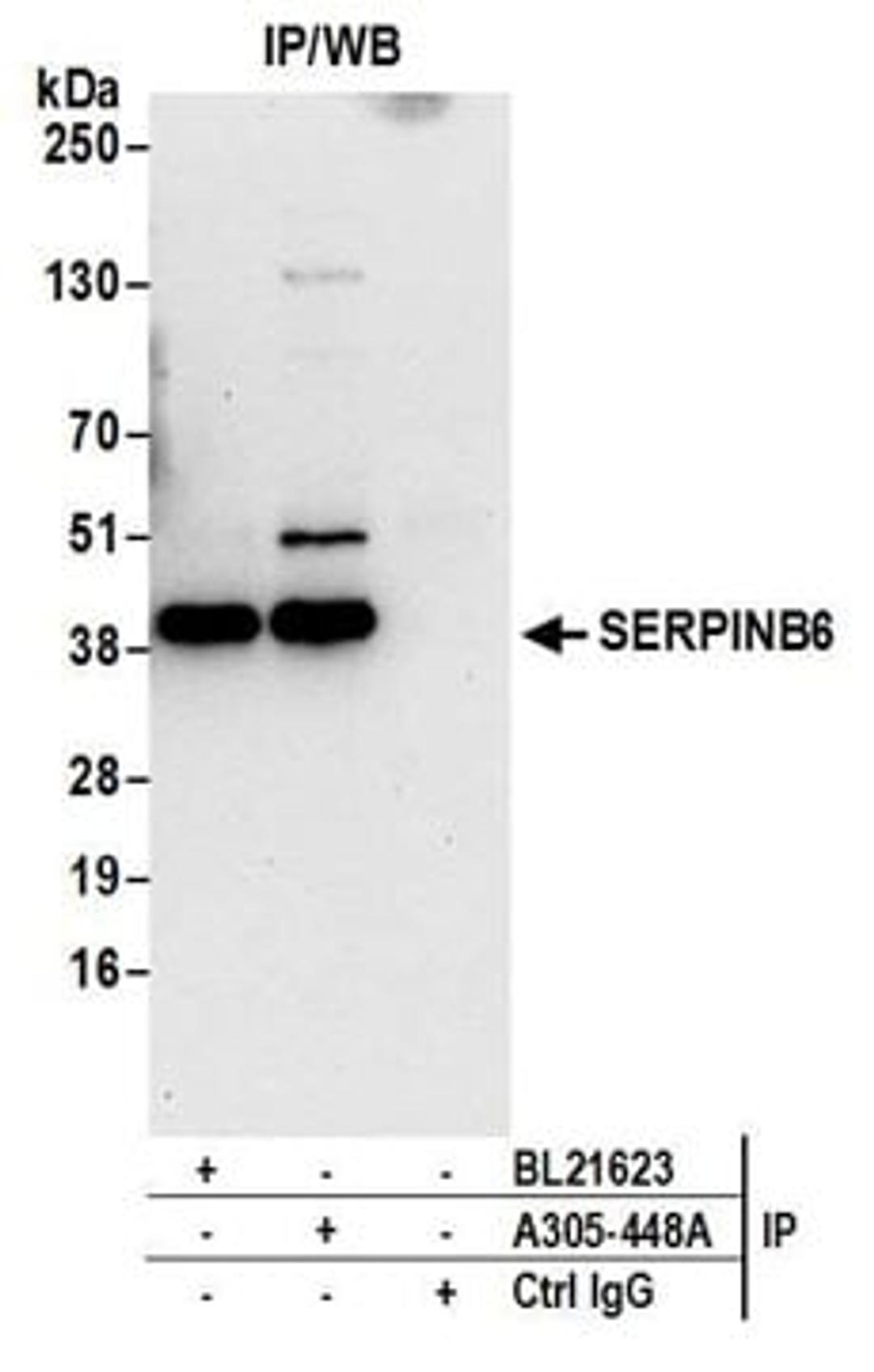 Detection of human SERPINB6 by western blot of immunoprecipitates.