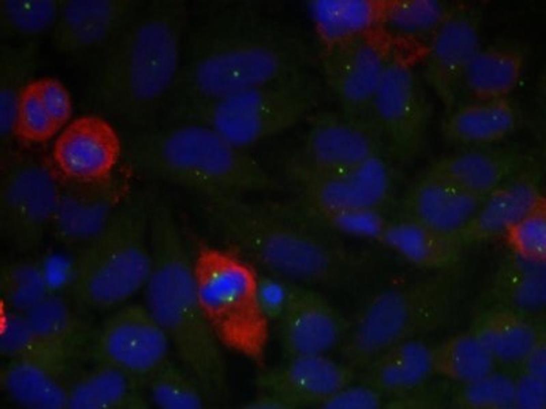 Immunocytochemistry/Immunofluorescence: NFkB p65 [p Thr435] Antibody [NB100-82089] - Staining of methanol-fixed HeLa cells.