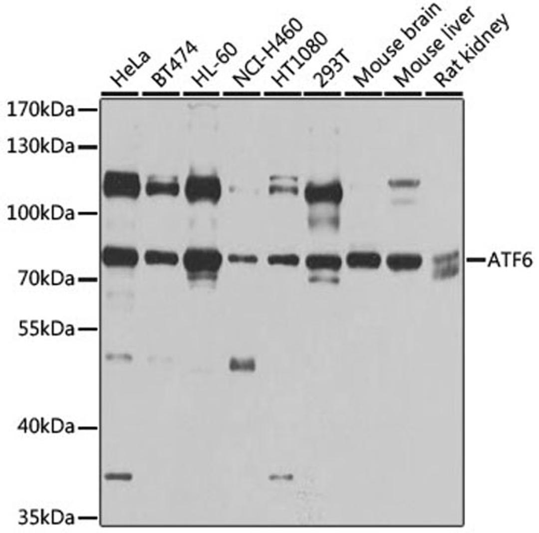 Western blot - ATF6 antibody (A0202)