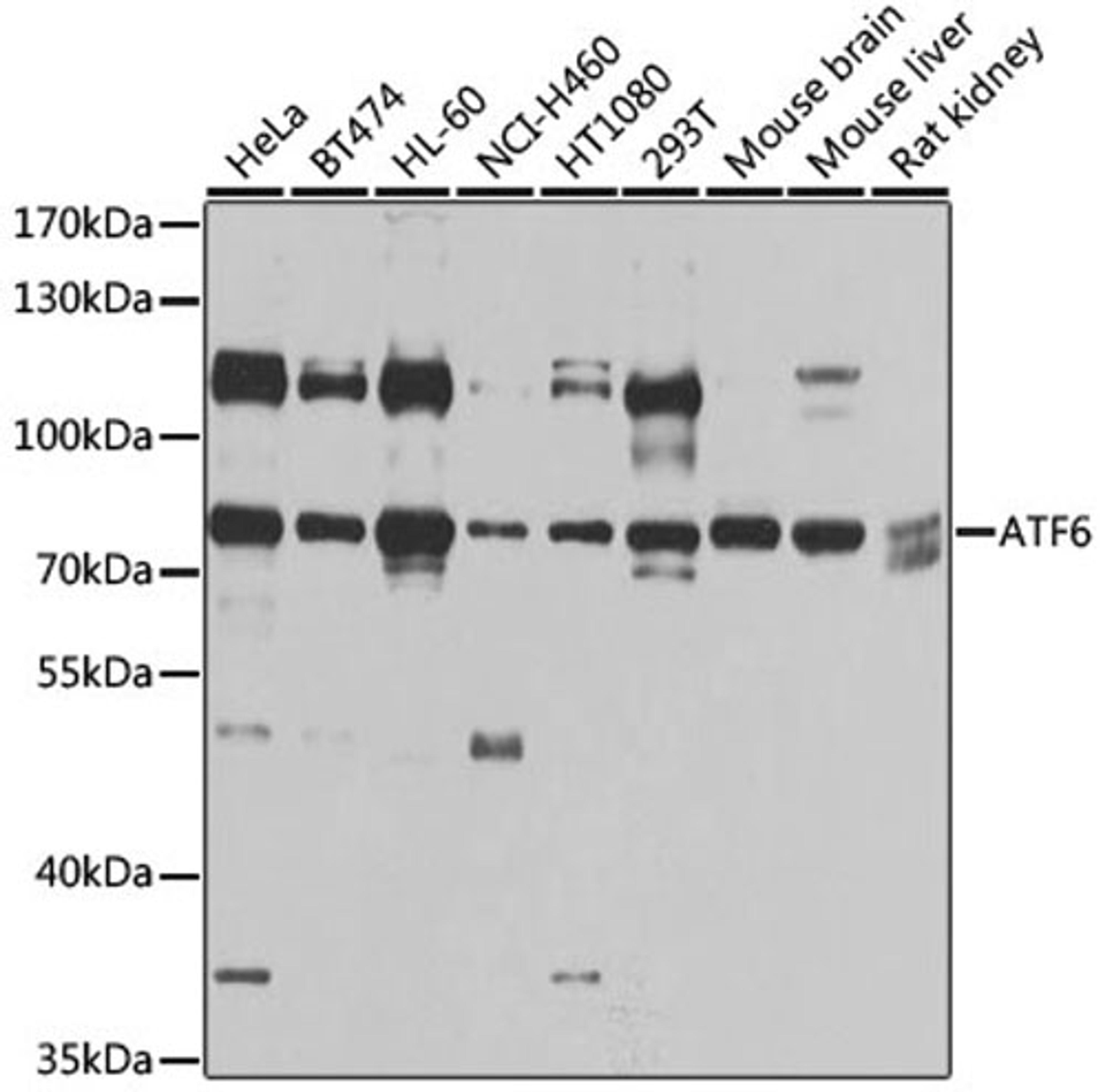 Western blot - ATF6 antibody (A0202)