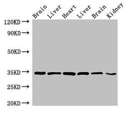 Western Blot. Positive WB detected in: Rat brain tissue, Rat liver tissue, Mouse heart tissue, Mouse liver tissue, Mouse brain tissue, Mouse kidney tissue. All lanes: MBP antibody at 4ug/ml. Secondary. Goat polyclonal to rabbit IgG at 1/50000 dilution. Predicted band size: 34, 22, 21, 19, 18 kDa. Observed band size: 34 kDa. 