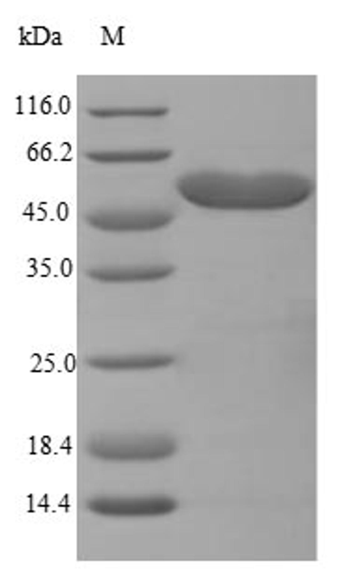 (Tris-Glycine gel) Discontinuous SDS-PAGE (reduced) with 5% enrichment gel and 15% separation gel.
