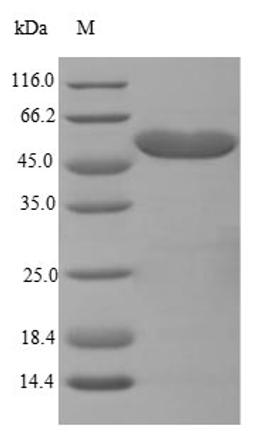 (Tris-Glycine gel) Discontinuous SDS-PAGE (reduced) with 5% enrichment gel and 15% separation gel.