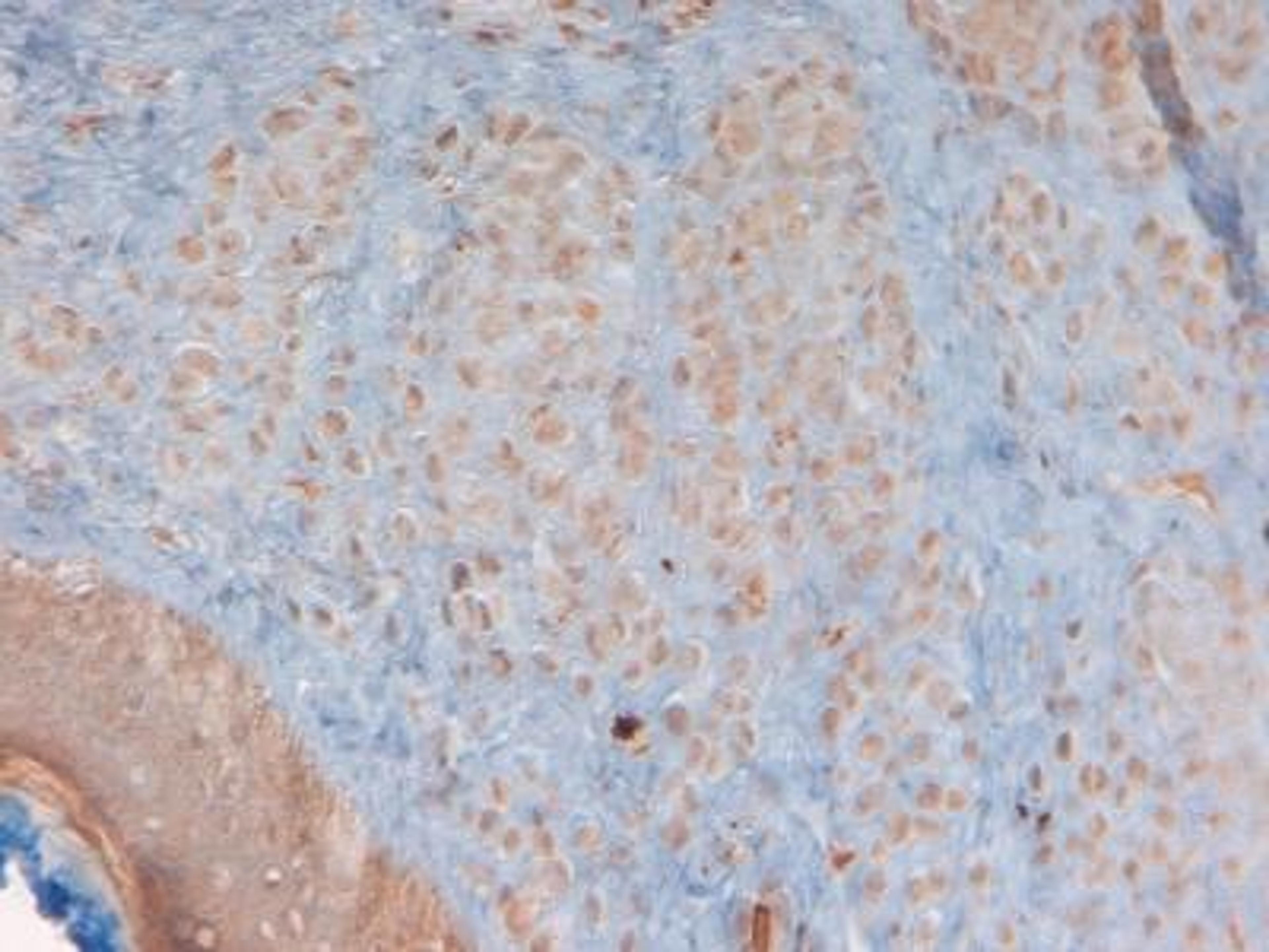 Immunohistochemistry-Paraffin: Defensin beta 3 Antibody [NB200-117] - IHC analysis of Defensin beta 3 in human skin.