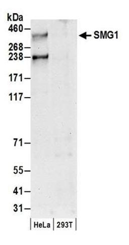 Detection of human SMG1 by western blot.