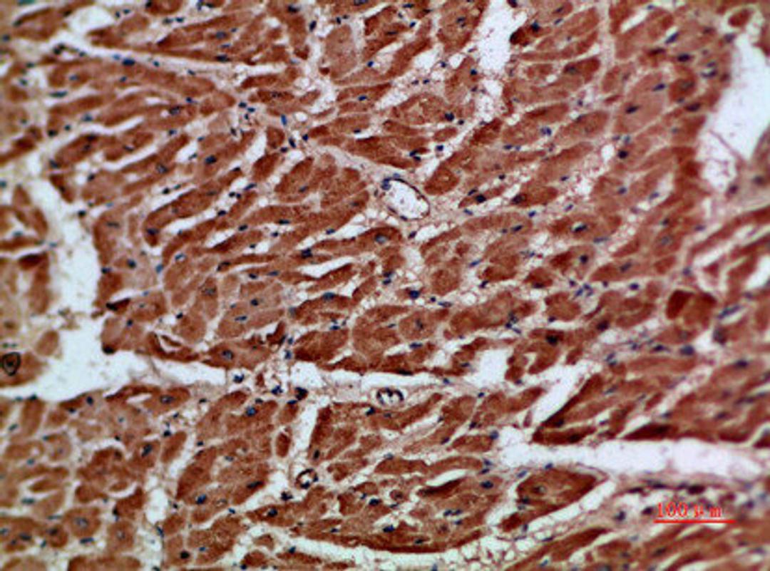 Immunohistochemical analysis of paraffin-embedded human-heart, antibody was diluted at 1:200