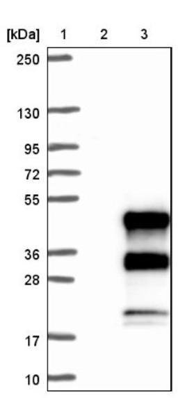 Western Blot: C12orf43 Antibody [NBP1-91713] - Lane 1: Marker [kDa] 250, 130, 95, 72, 55, 36, 28, 17, 10<br/>Lane 2: Negative control (vector only transfected HEK293T lysate)<br/>Lane 3: Over-expression lysate (Co-expressed with a C-terminal myc-DDK tag (~3.1 kDa) in mammalian HEK293T cells, LY411468)