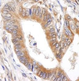 Detection of human BID by immunohistochemistry.