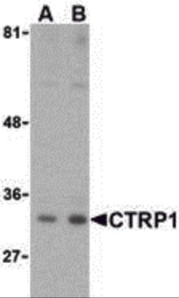 Western blot analysis of CTRP1 in MDA-MD-361 cell lysate with CTRP1 (IN) antibody at (A) 1 and (B) 2 &#956;g/mL.