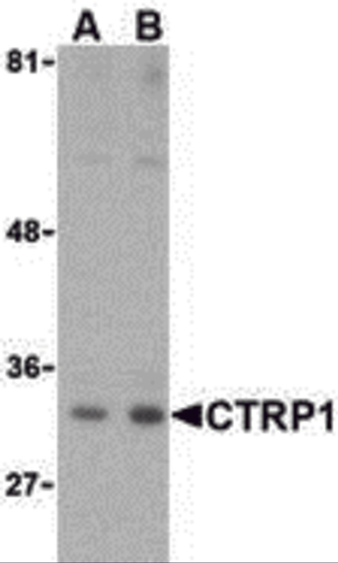Western blot analysis of CTRP1 in MDA-MD-361 cell lysate with CTRP1 (IN) antibody at (A) 1 and (B) 2 μg/mL.