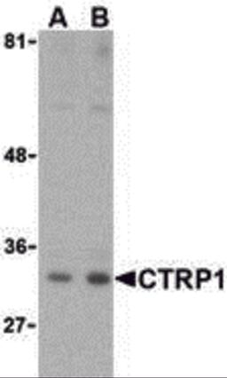Western blot analysis of CTRP1 in MDA-MD-361 cell lysate with CTRP1 (IN) antibody at (A) 1 and (B) 2 μg/mL.