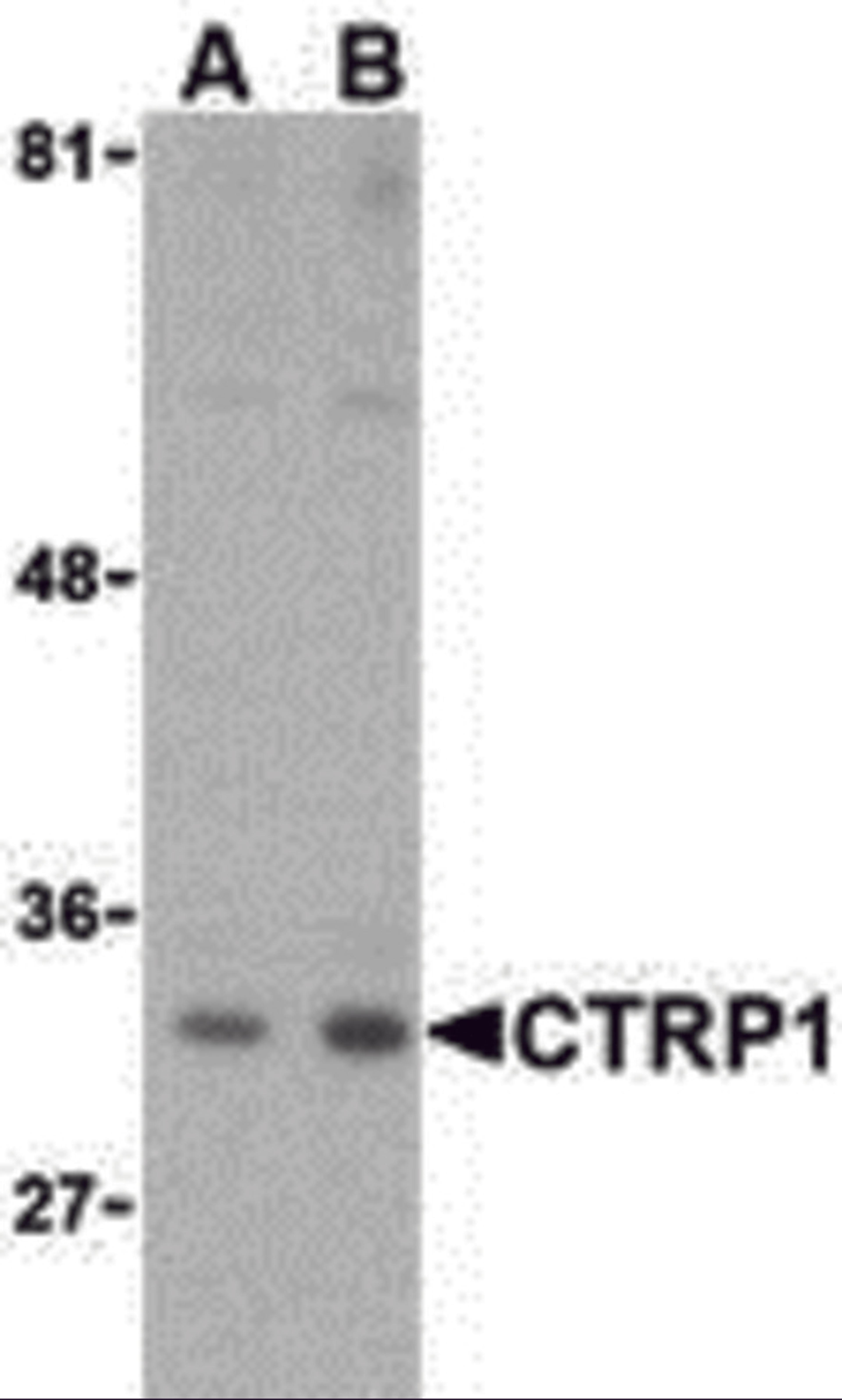 Western blot analysis of CTRP1 in MDA-MD-361 cell lysate with CTRP1 (IN) antibody at (A) 1 and (B) 2 μg/mL.