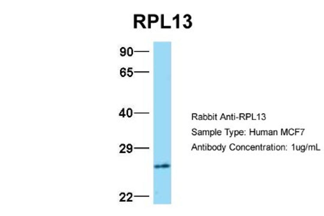 Western Blot: RPL13 Antibody [NBP1-57476] - MCF7, Antibody Dilution: 1.0 ug/ml RPL13 is strongly supported by BioGPS gene expression data to be expressed in MCF7.