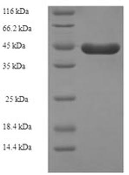 (Tris-Glycine gel) Discontinuous SDS-PAGE (reduced) with 5% enrichment gel and 15% separation gel.