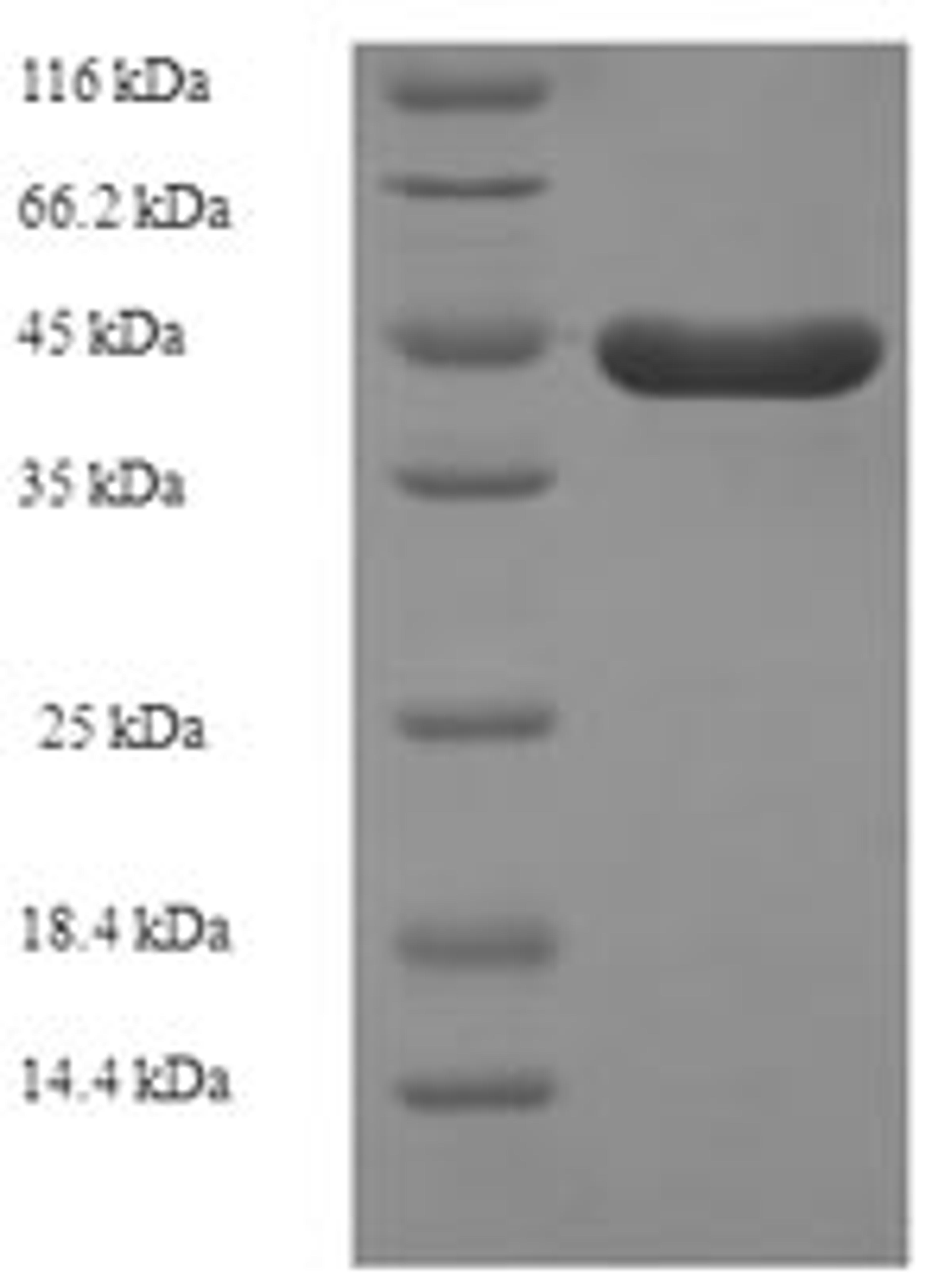 (Tris-Glycine gel) Discontinuous SDS-PAGE (reduced) with 5% enrichment gel and 15% separation gel.