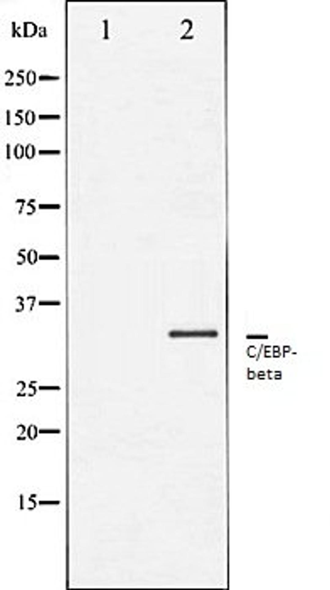 Western blot analysis of NIH-3T3 whole cell lysates using C/EBP-beta antibody, The lane on the left is treated with the antigen-specific peptide.