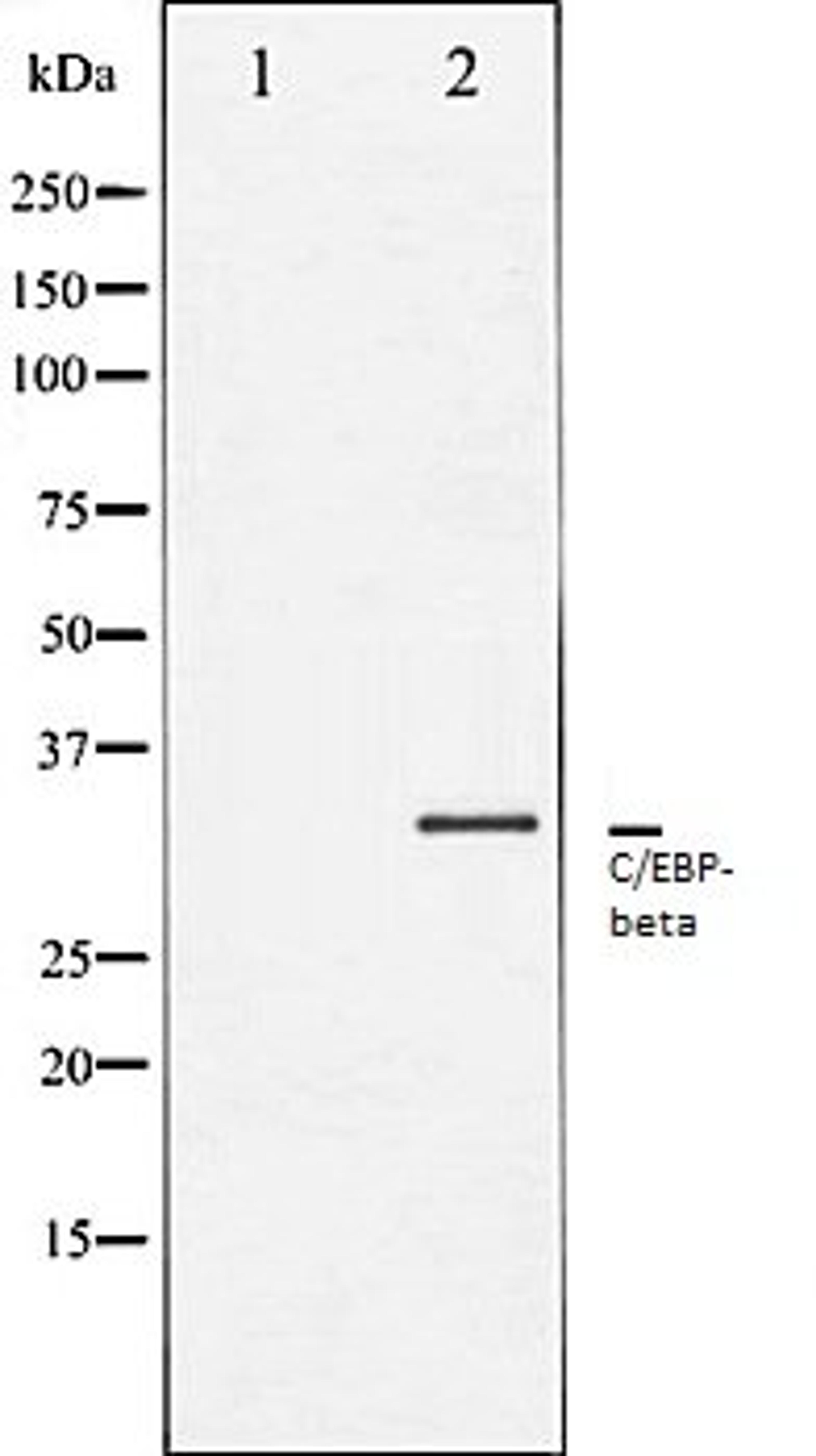 Western blot analysis of NIH-3T3 whole cell lysates using C/EBP-beta antibody, The lane on the left is treated with the antigen-specific peptide.