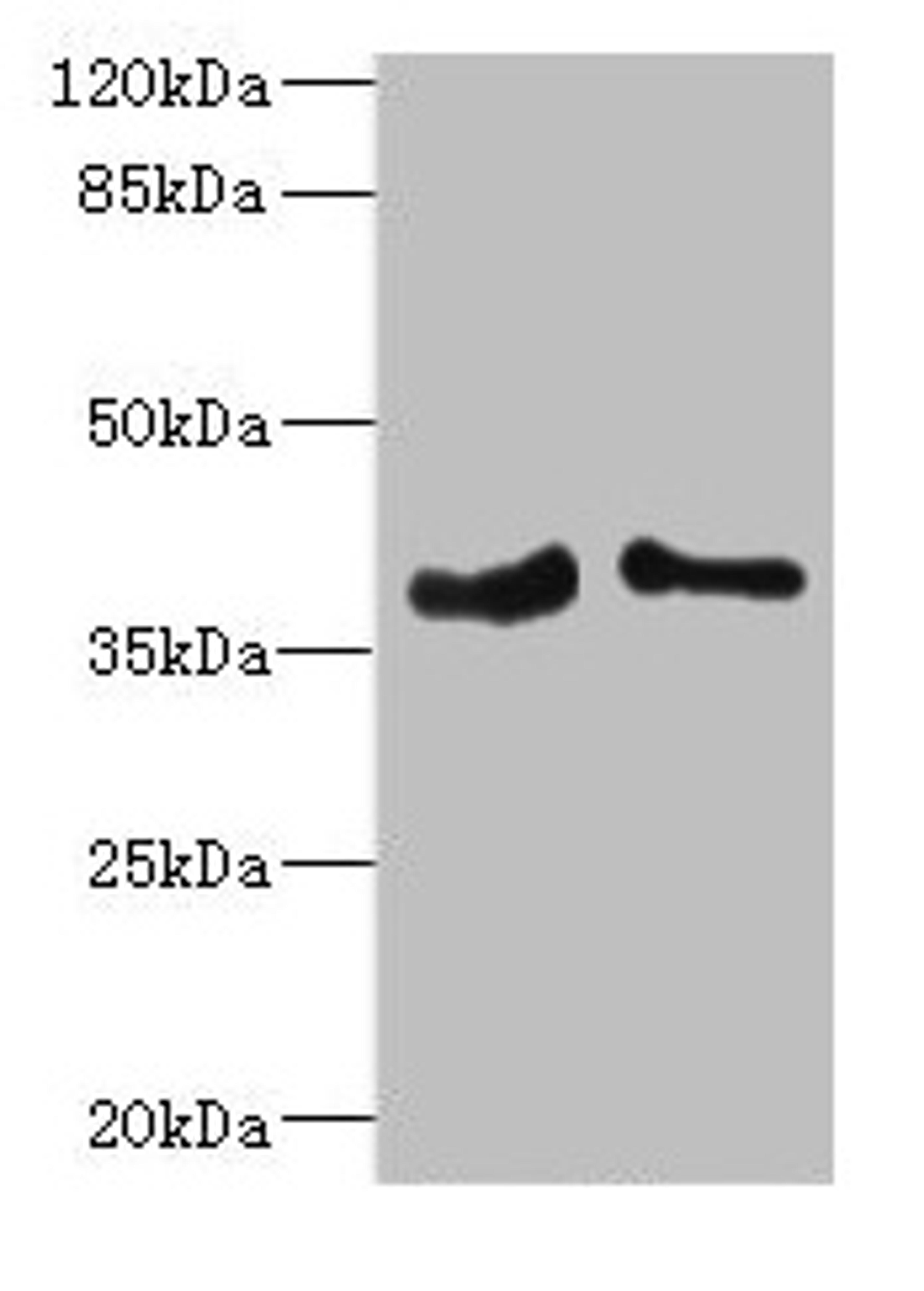 Western blot. All lanes: PHF11 antibody at 4.36µg/ml. Lane 1: Jurkat whole cell lysate. Lane 2: Hela whole cell lysate. Secondary. Goat polyclonal to rabbit IgG at 1/10000 dilution. Predicted band size: 38, 34 kDa. Observed band size: 38 kDa