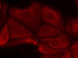 Immunocytochemistry/Immunofluorescence: S6K [p Ser411] Antibody [NB100-82120] - Staining of methanol-fixed MCF7 cells using p70 S6 Kinase(Phospho-Ser411) antibody