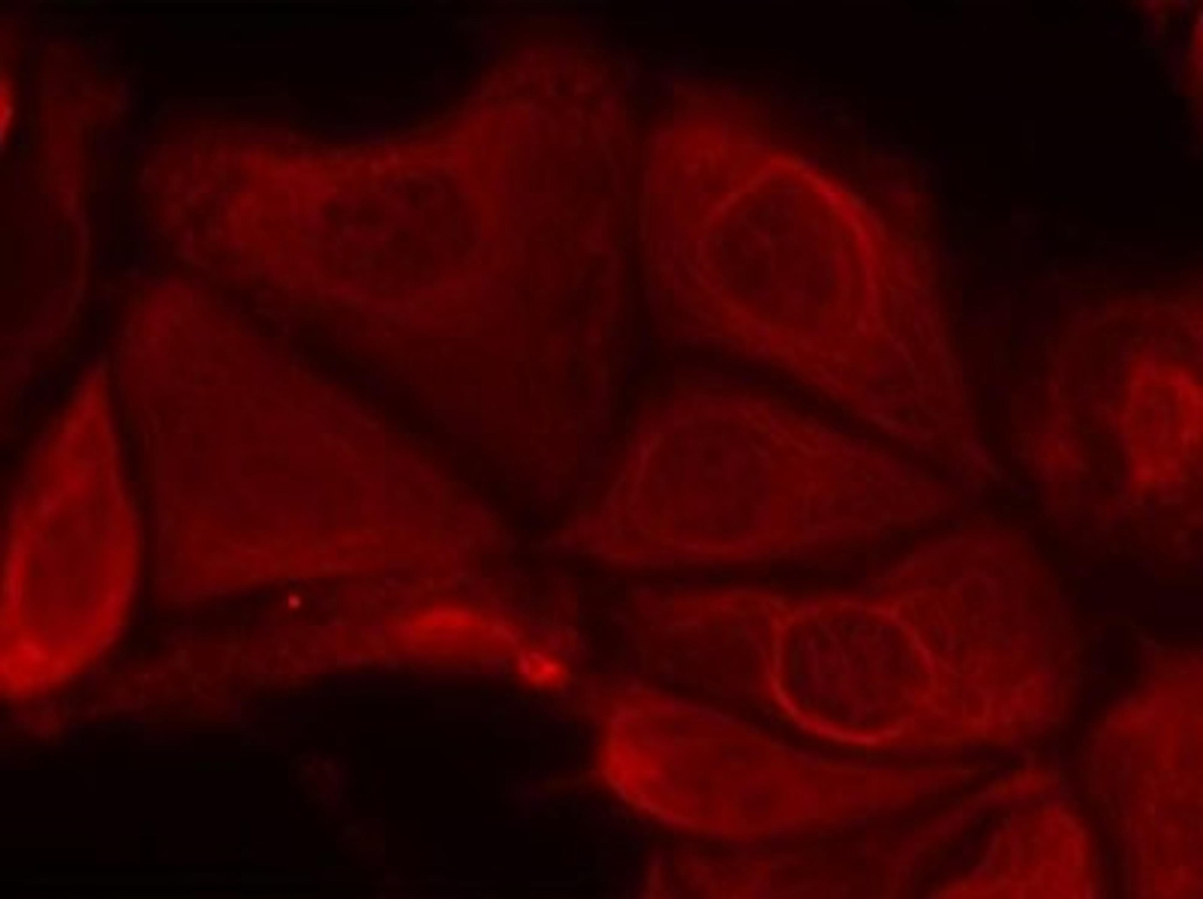 Immunocytochemistry/Immunofluorescence: S6K [p Ser411] Antibody [NB100-82120] - Staining of methanol-fixed MCF7 cells using p70 S6 Kinase(Phospho-Ser411) antibody