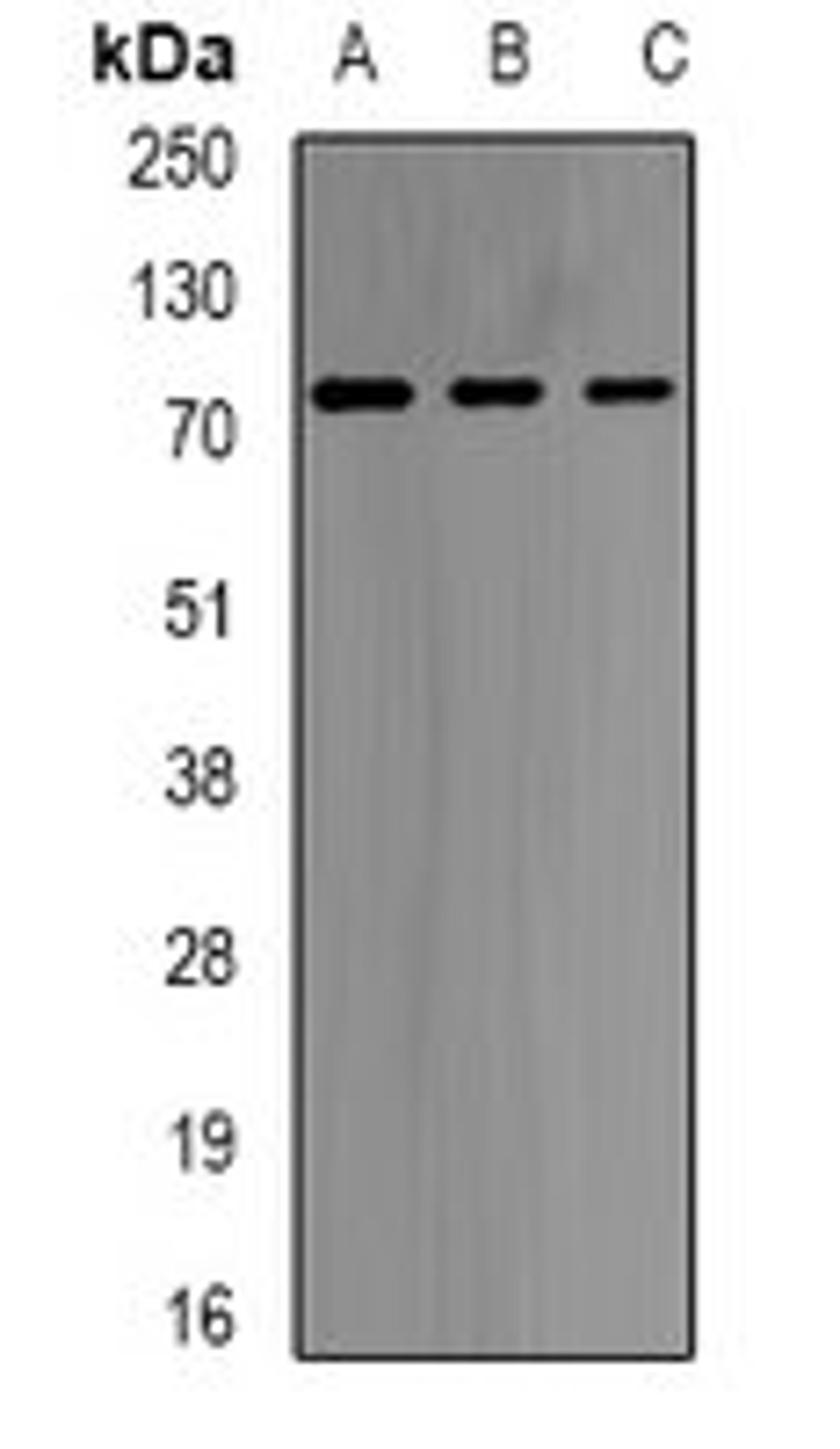 Western blot analysis of HT29 (Lane1), MCF7 (Lane2), mouse liver (Lane3) whole cell lysates using UGT1A9 antibody