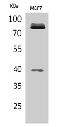 Western blot. All lanes: IL1R1 antibody at 6µg/ml. Lane 1: Hela whole cell lysate. Lane 2: Mouse heart tissue. Secondary. Goat polyclonal to rabbit IgG at 1/10000 dilution. Predicted band size: 65 kDa. Observed band size: 65 kDa