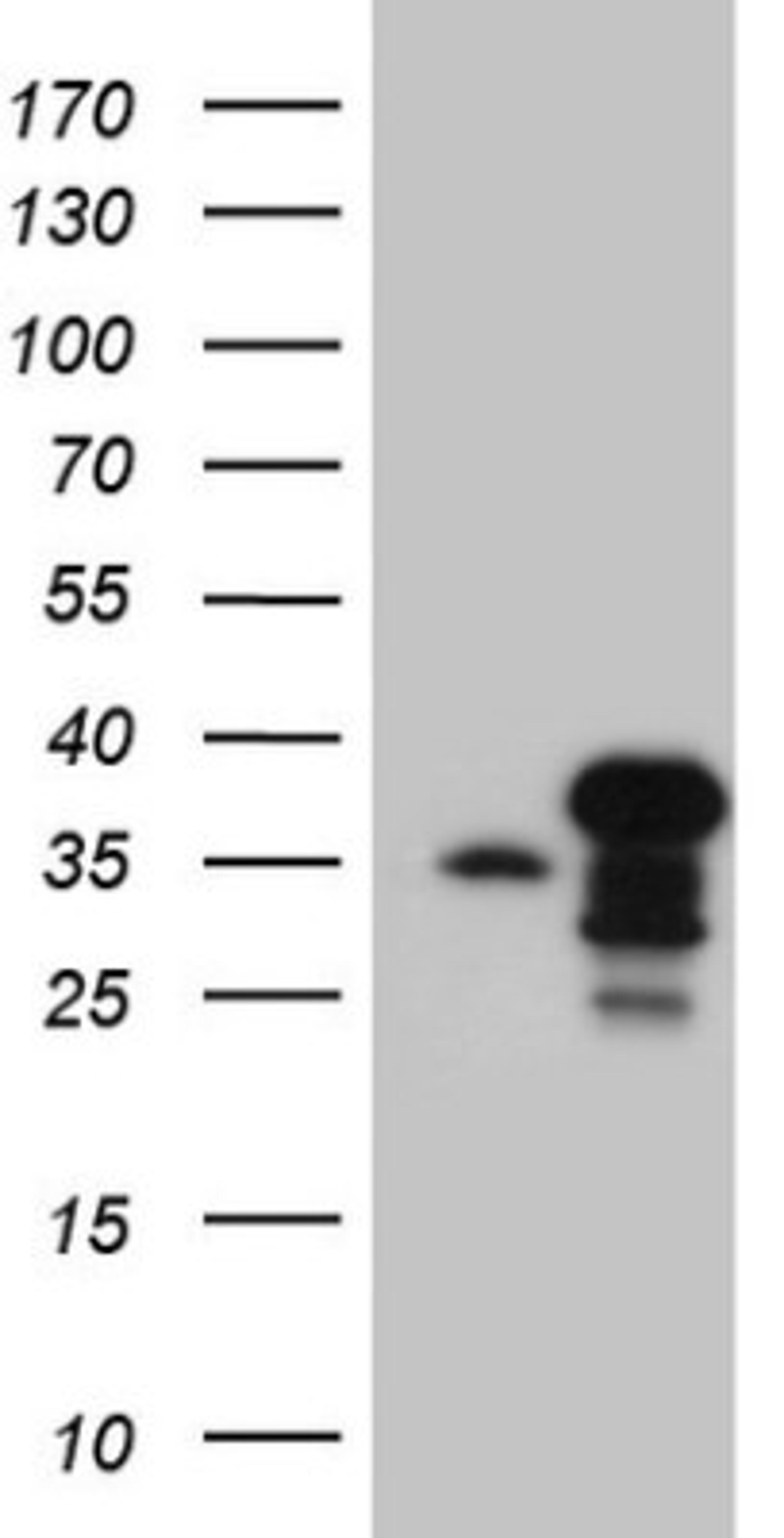 Immunohistochemistry: SPT3 Antibody (1A5) [NBP2-45466] - Analysis of HEK293T cells were transfected with the pCMV6-ENTRY control (Left lane) or pCMV6-ENTRY SPT3.