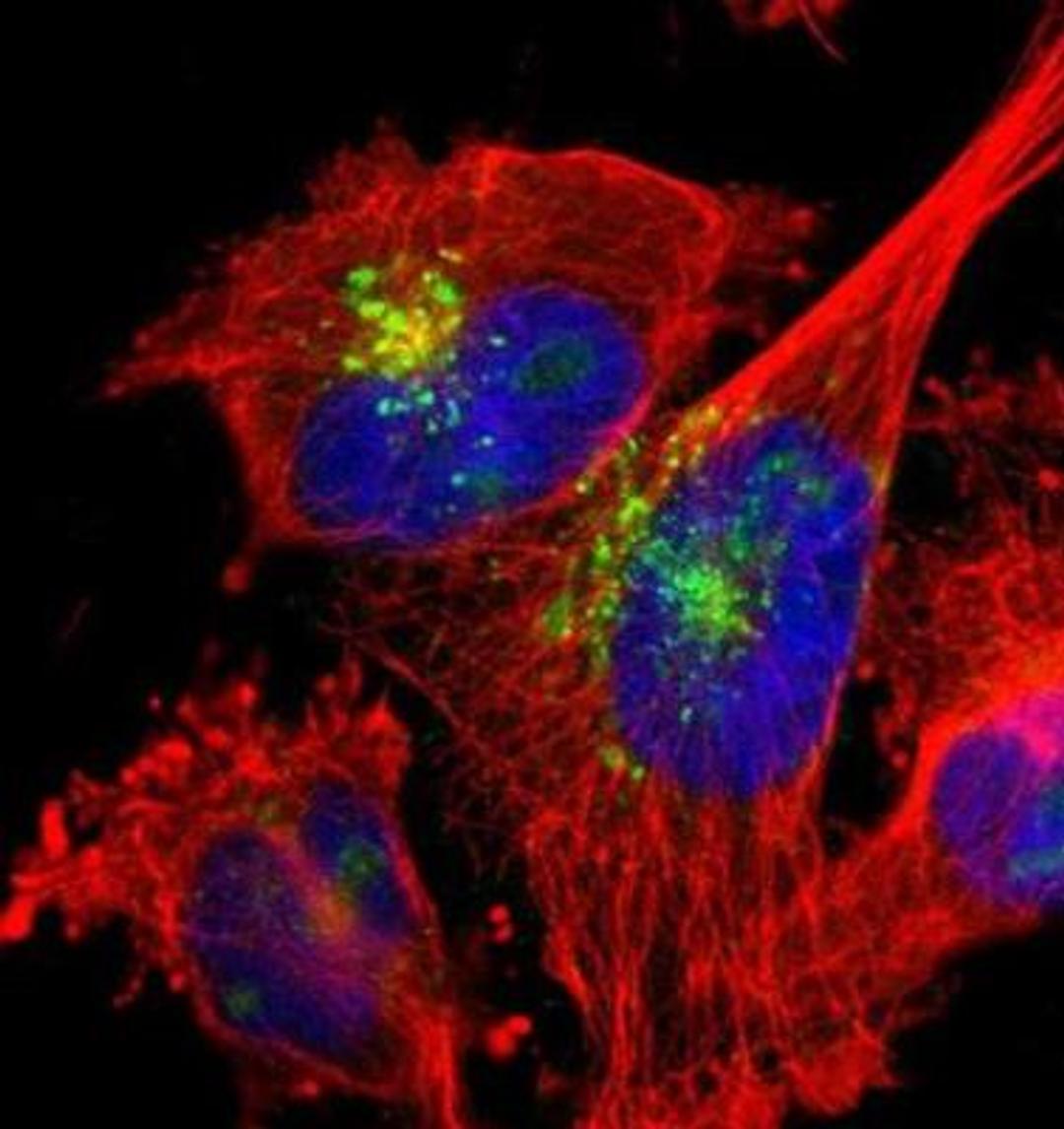 Immunocytochemistry/Immunofluorescence: GPRC5A/RAI3 Antibody [NBP1-89743] - Staining of human cell line U-251 MG shows positivity in vesicles.