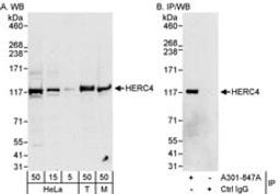 Detection of human and mouse HERC4 by western blot (h&m) and immunoprecipitation (h).