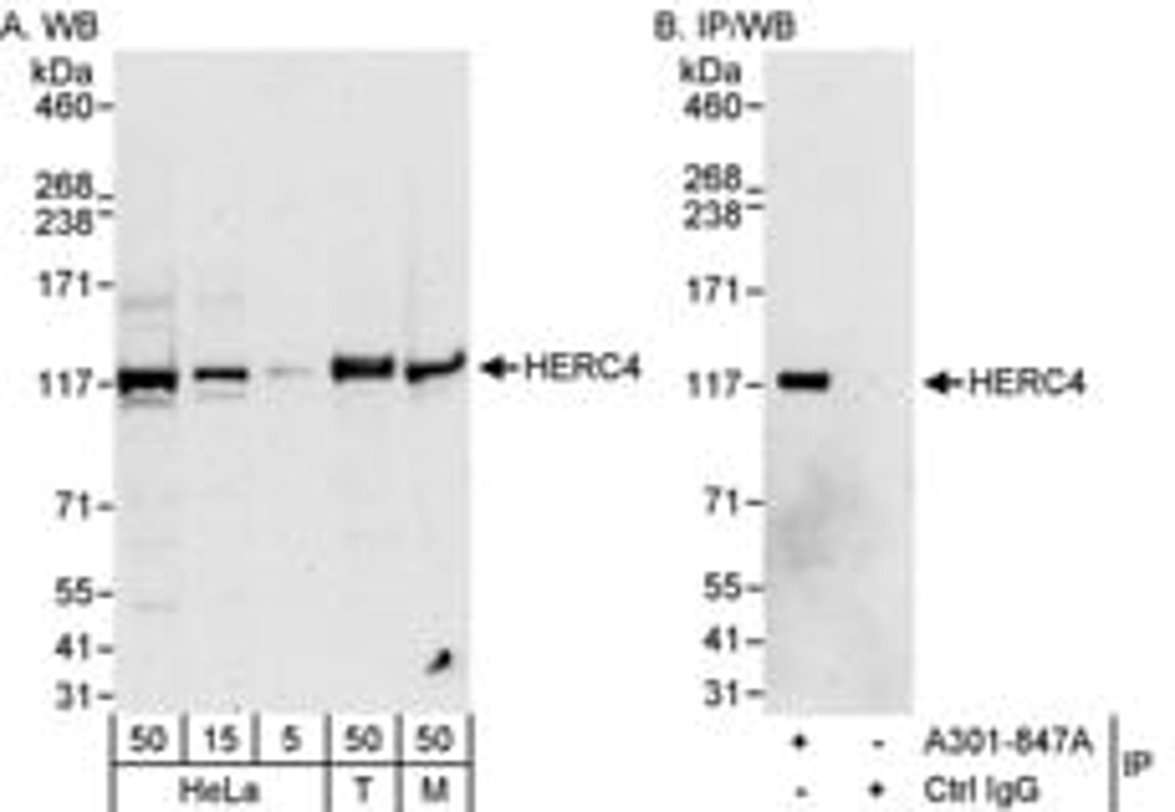 Detection of human and mouse HERC4 by western blot (h&m) and immunoprecipitation (h).