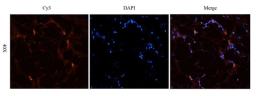 Immunofluorescence image of human endometrial cancer tissue using anti-HOXA10 (2.5 ug/ml)