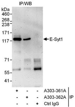 Detection of human E-Syt1 by western blot of immunoprecipitates.